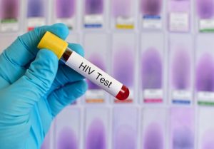HIV test