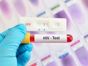 hiv test 1