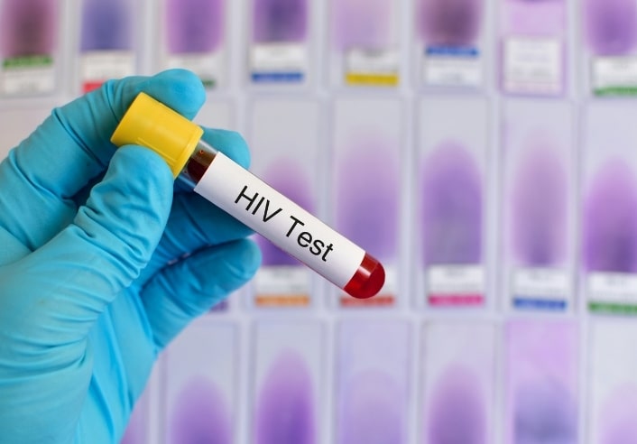 anoymous hiv test