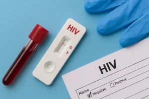 HIV testing